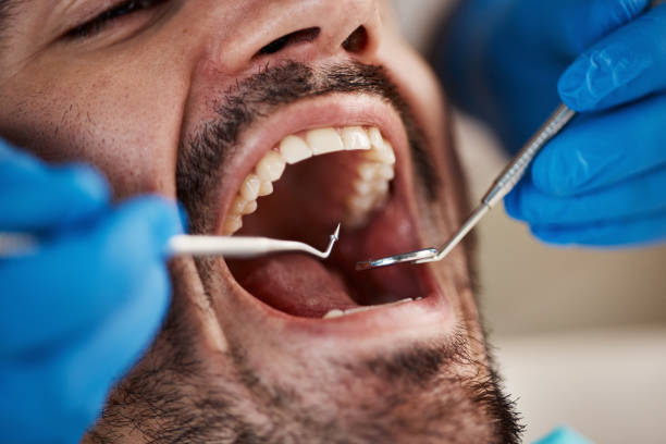 Best Emergency Dentist for Special Needs Patients in Batesville, IN